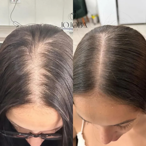 Сыворотка SORRY FOR MY HAIR DHT Control & Hairgrow Complex 5.0 для восстановления роста волос 50 мл 1762 фото