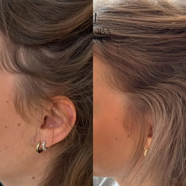 Сироватка SORRY FOR MY HAIE Biostim O3 Peptide Serum з біоактивними пептидами для стимуляції росту волосся 50 мл 1763 фото