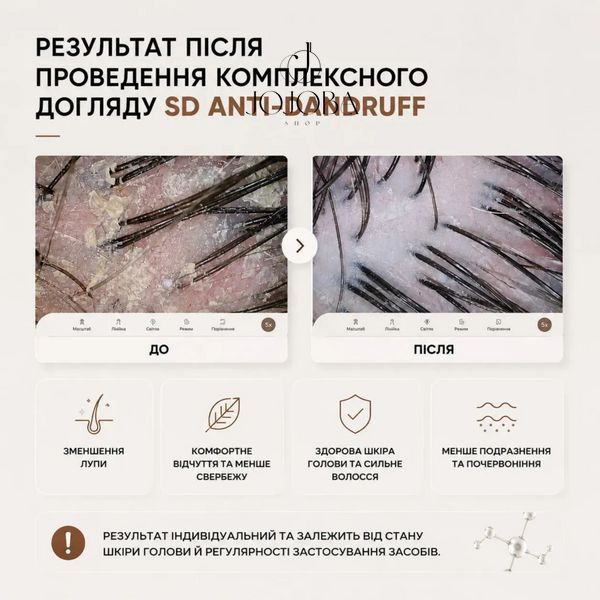 Лосьон FULL FORCE SD ANTI-DANDRUFF scalp lotion для кожи склонной к перхоти 50 мл 1010 фото